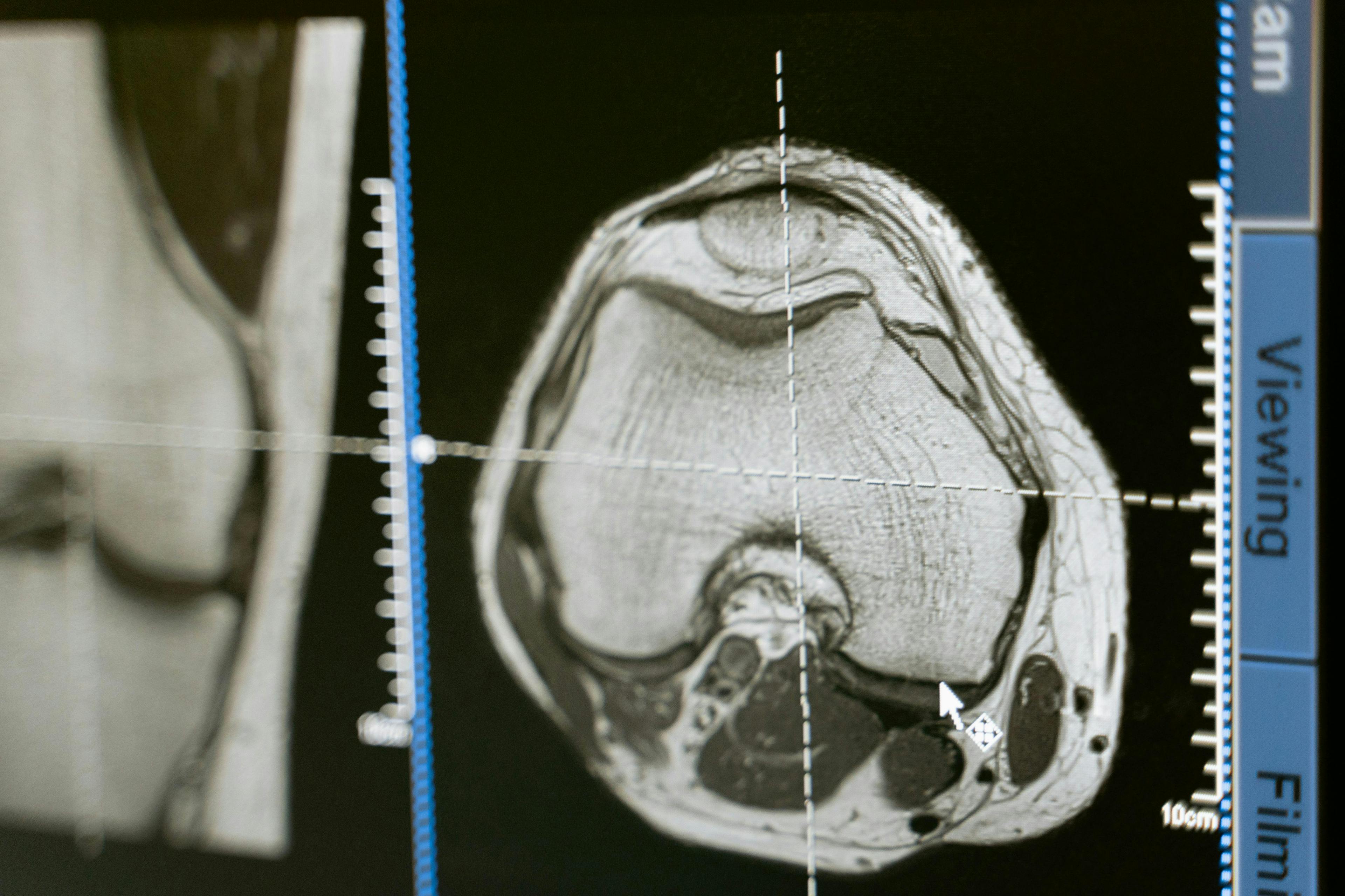 Advancements in Brain Imaging Technology at Brain Mapping Solutions Image