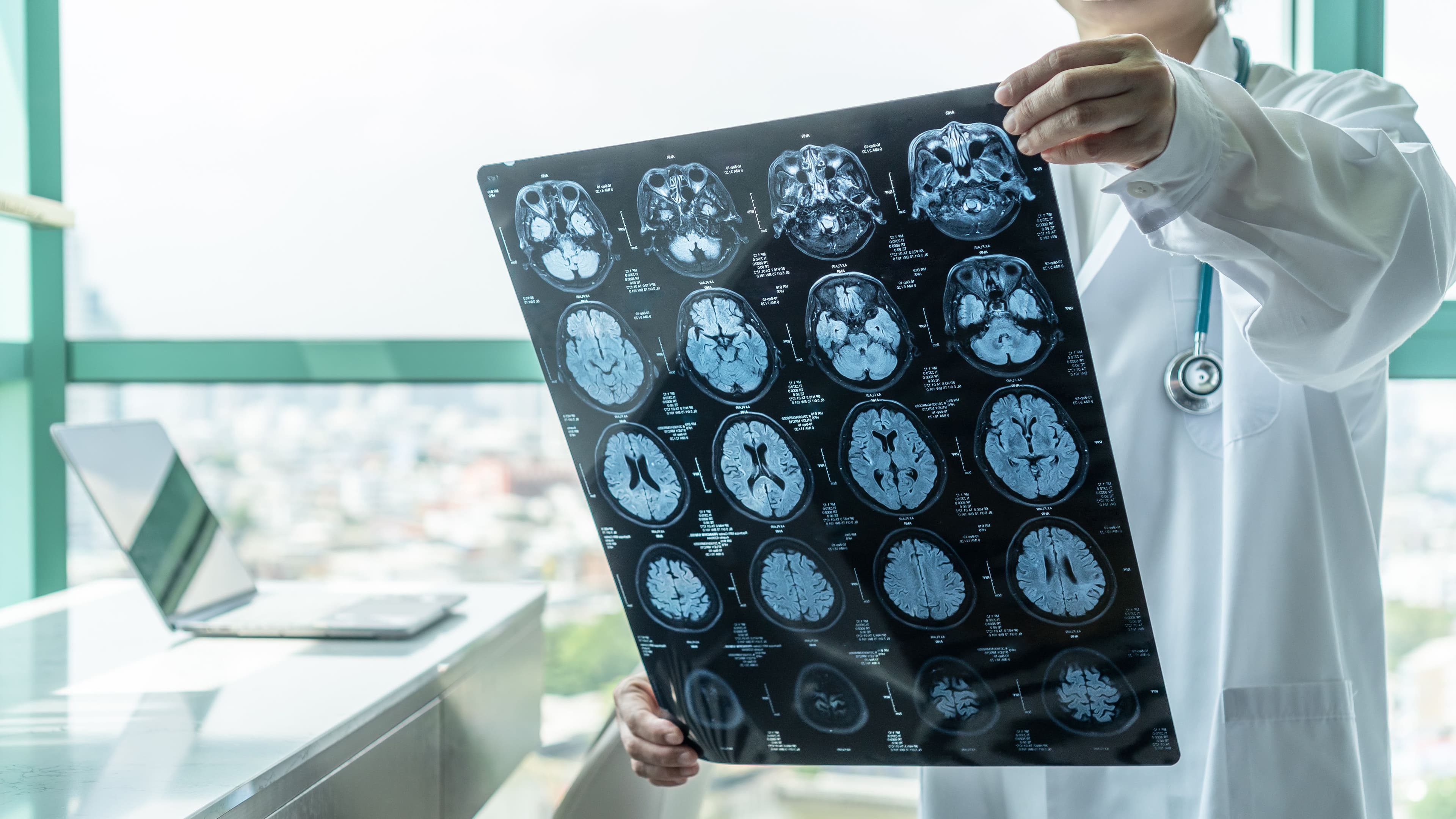 Using Cognitive and Behavioral Impact Analysis to Improve Brain Injury Recovery Image