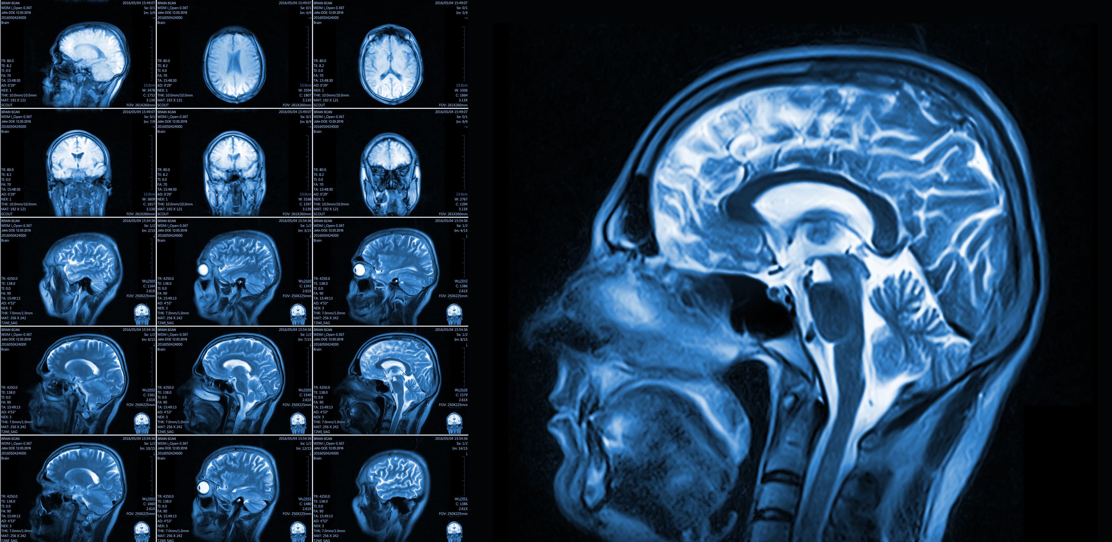 Maximizing Recovery through Location-Specific Brain Injury Identification Image