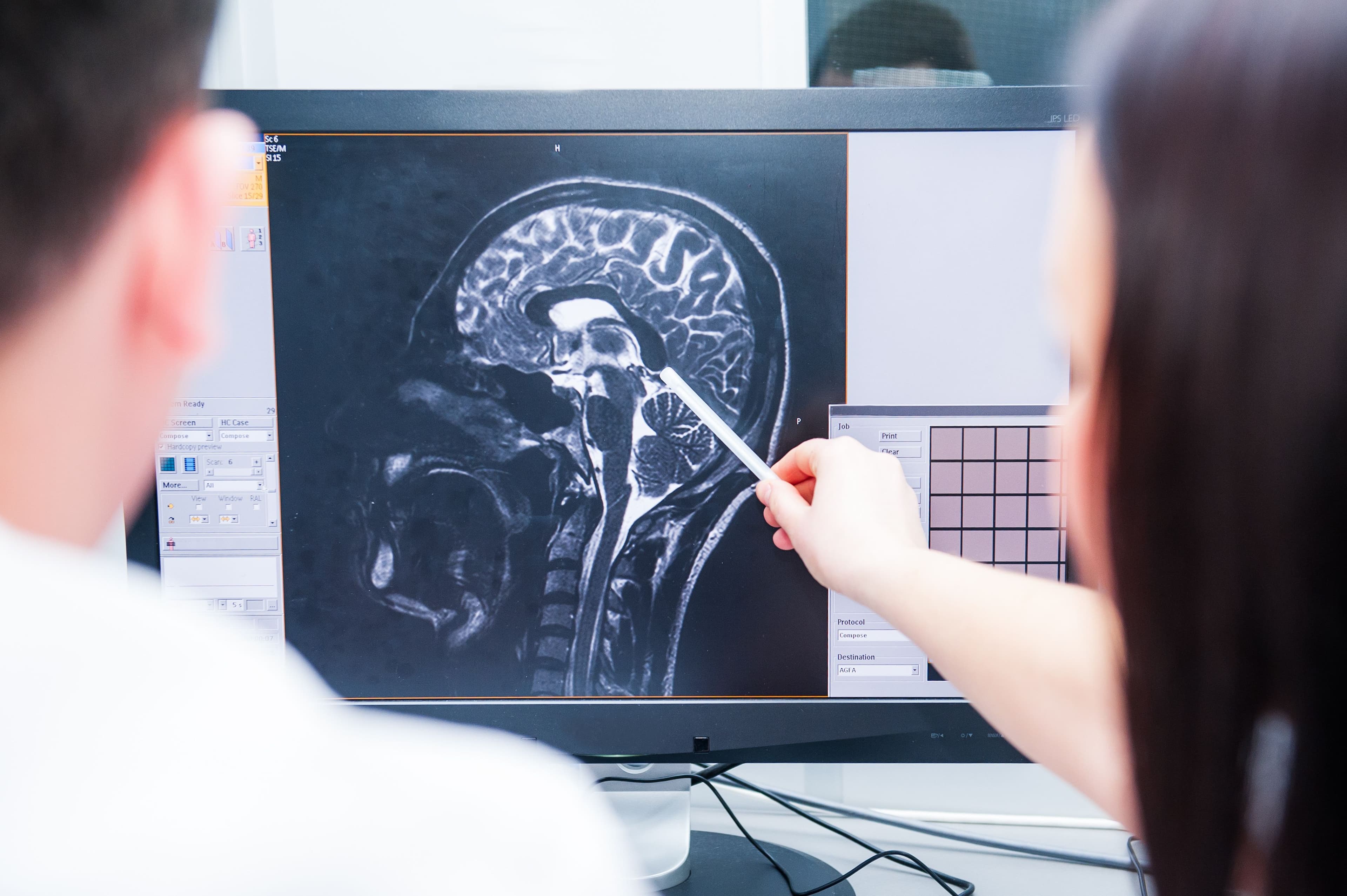 Expanding Access to Neuroimaging: Brain Mapping Solutions' Partnerships with Imaging Centers Image
