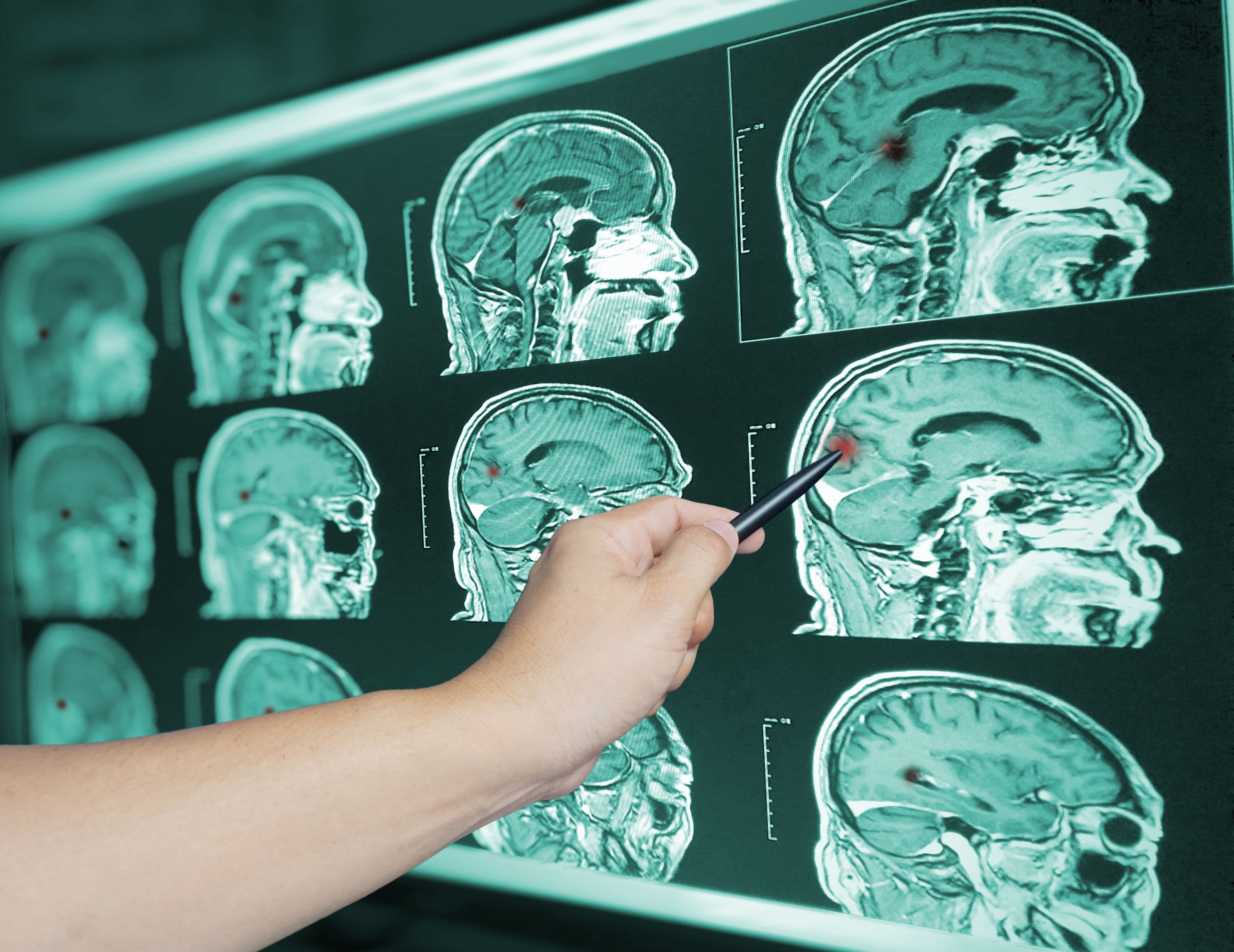 Building Strong Partnerships with Imaging Centers for Better Neuroimaging Access Image