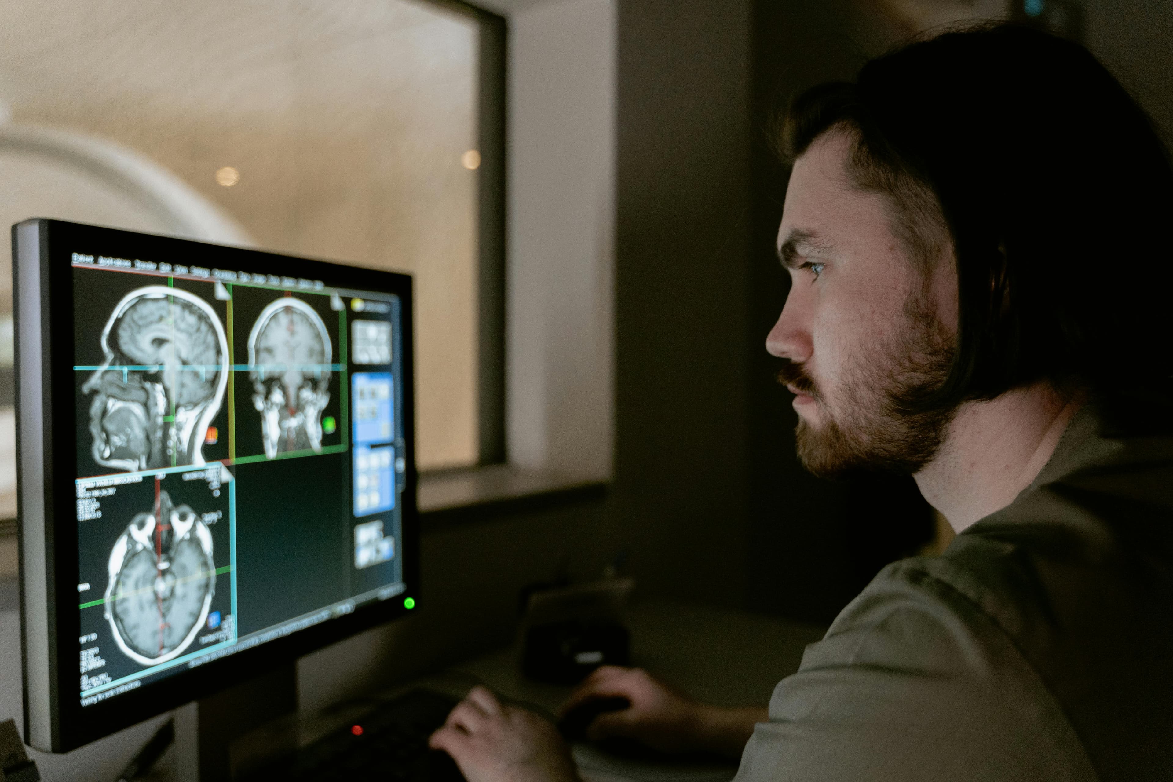 The Role of Brain Mapping Solutions in Brain Injury Rehabilitation Image