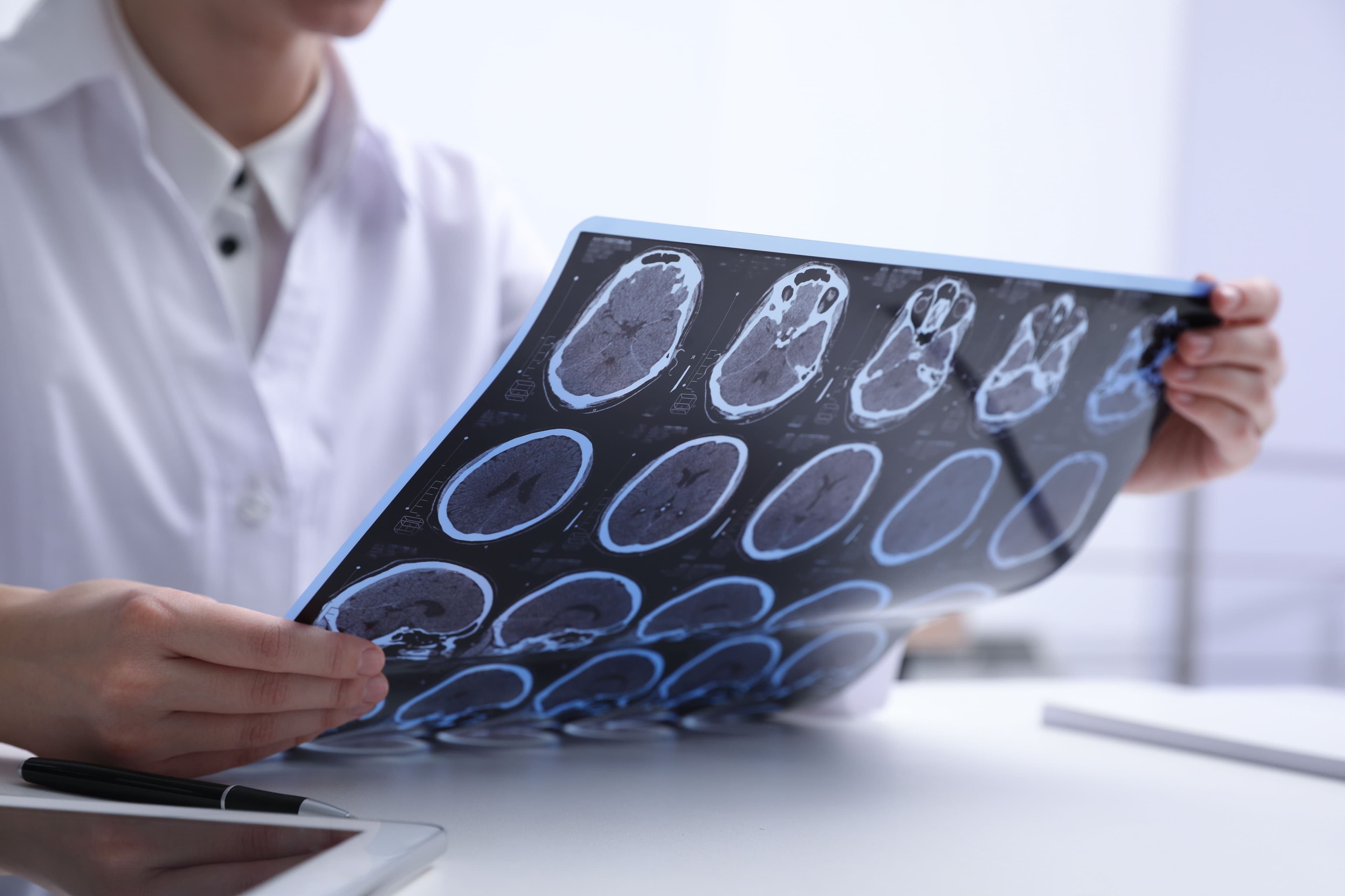 Cognitive and Behavioral Impact Analysis: Understanding Brain Injuries with Brain Mapping Solutions Image