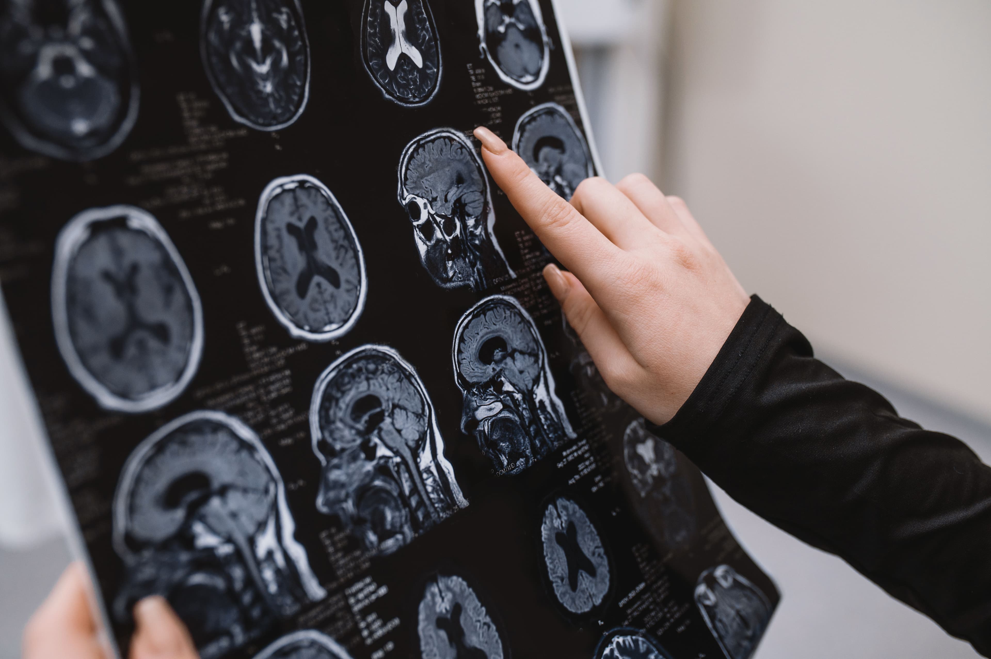 Location-Specific Injury Identification: Revolutionizing Brain Injury Diagnosis Image