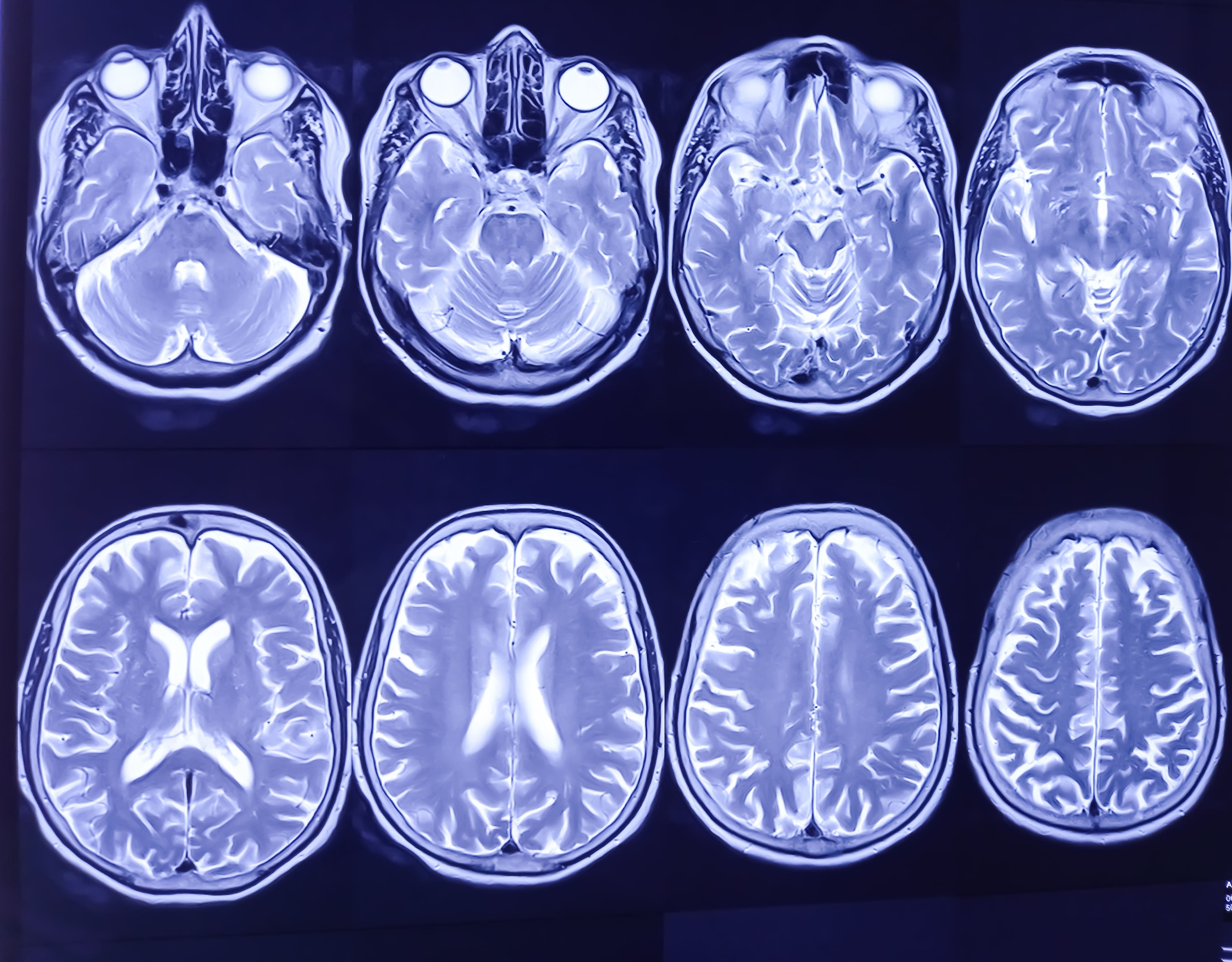 The Future of Brain Imaging with Brain Mapping Solutions Image